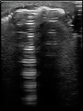 FIGURE 12 SUBQ AIR REVERBERATION copy.jpg