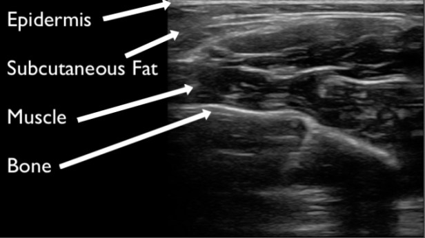 Figure 3 - muscle short axis copy.jpg