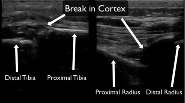 Figure 9 - Fractures copy.jpg