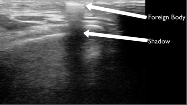 OPSC FB annotated white copy.jpg