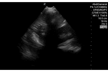 QA of the day fluid in stomach ruggae