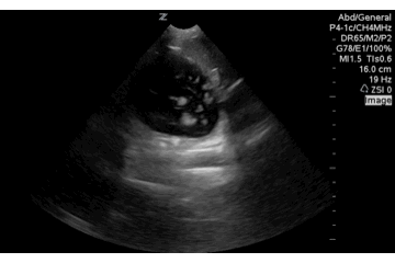 QA of the day fluid in stomach