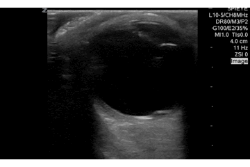 eye-movements-and-rd