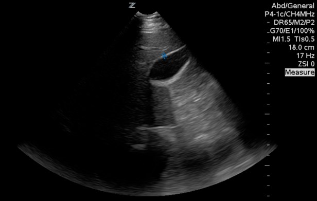 gb-correct-wall-measurement