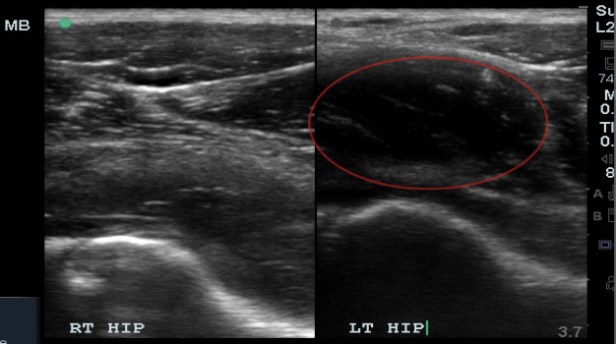 hip case dual screen copy